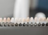 découvrez tout ce qu'il faut savoir sur les prothèses dentaires : types, avantages, pose et entretien pour retrouver un sourire éclatant et une meilleure santé bucco-dentaire.