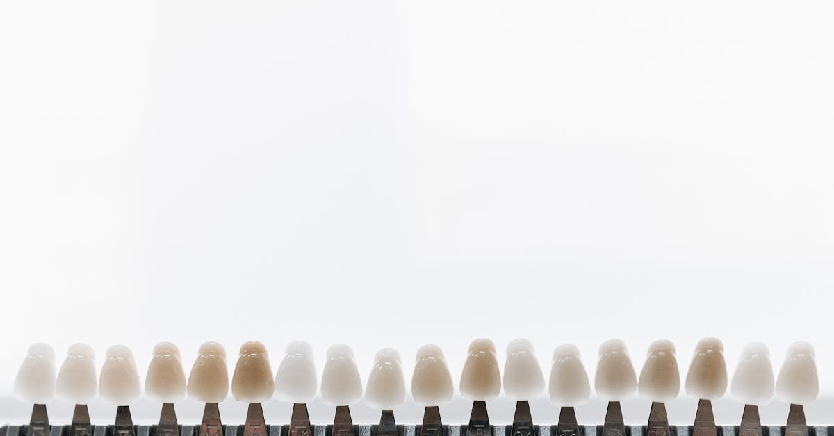 découvrez tout ce qu'il faut savoir sur les prothèses dentaires : types, avantages, entretien et conseils pour un sourire sain et esthétique.