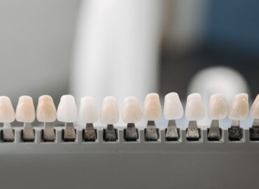 découvrez tout ce qu'il faut savoir sur les prothèses dentaires : types, avantages, pose et entretien pour retrouver un sourire éclatant et une meilleure santé bucco-dentaire.